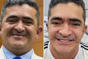 Mendes brinca com novo visual de Elizeu: &ldquo;Botelho perdeu feio&rdquo;