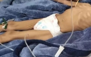 Sem comer h&aacute; 40 dias, menina de 3 anos &eacute; resgatada e pai &eacute; preso